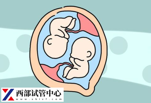 双胞胎流产的风险略高于单胎