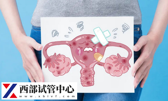 子宫内膜异位症是一种妇科疾病