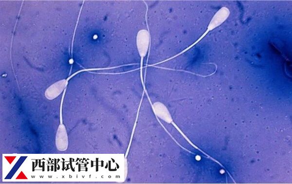 精子检查最好去正规三甲医院