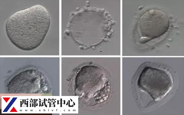 3个囊胚筛选<a href=https://www.nzzt.cn/topic/92.html target=_blank class=infotextkey>成功率</a>大概在40%-45%左右
