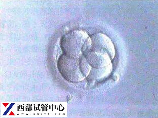 平衡易位会遗传给后代