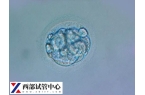 试管移植13天水印正不正常看这，或与胚胎