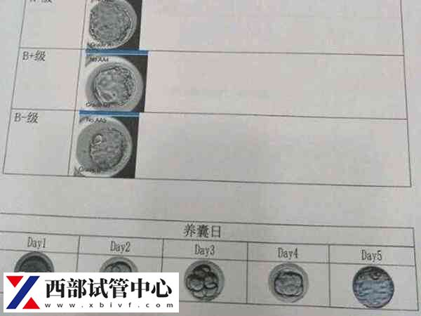 囊胚比早期细胞多培育了两天