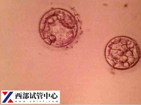 3cb囊胚成功率多高(图1) 3CB囊胚属于非优质囊胚
