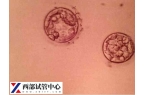 3cb囊胚成功率多高